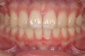 001741_20140510_0037